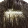Healthlif Hairpieces Mens Toupee Human Hair Replacement System Natural Lace Front Toupee for Men Lace Poly Coated Men's Hair Pieces Systems Protesis Capilar 6''X8'' #310 Dark Brown+10% Gray view 4