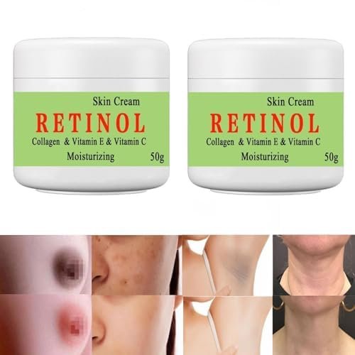 50ml*2PCS Cremas Para Las Manchas De La Cara, Crema Para La Cara Antiarrugas, Face Moisturizing Cream, Para Piel Entrepierna, Manchas Codos, Piernas Zonas