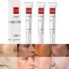 3PCS Crema Para Las Manchas De La Cara, Crema para la cara Antiarrugas Face Moisturizer Cream,Adecuado para varias reas como cara, axilas, cuello, zona privade view 1