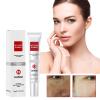 3PCS Crema Para Las Manchas De La Cara, Crema para la cara Antiarrugas Face Moisturizer Cream,Adecuado para varias reas como cara, axilas, cuello, zona privade view 2