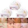 BEROZA 3PCS Cremas Para Las Manchas De La Cara, Crema De Arroz Para Blanquear La Piel, Adecuado para varias reas como cara, axilas, cuello, zona privade view 1