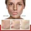 BEROZA 3PCS Cremas Para Las Manchas De La Cara, Crema De Arroz Para Blanquear La Piel, Adecuado para varias reas como cara, axilas, cuello, zona privade view 4