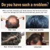 200ml Spartan Repair Shampoo Root Activator Shampoo for Men: Hair Growth Shampoo for Hair Loss and Thinning Hair, For Anti-Hair Loss, Natural Regrowth Formula for Men and Women view 2