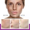 BEROZA 3PCS Crema Para Las Manchas De La Cara, Cremas para Quitar Manchas de La Cara, Face Moisturizer Cream,Adecuado para varias reas como cara, axilas, cuello, zona privade view 4