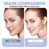 Pimple Patches for Face, 720 Count 2 Size Acne Patches Day and Night, Hydrocolloid Patch Pimple Stickers for Face and Skin Zits Absorbing Patch Covering Zits Blemishes (Skin tone & transparent colour) view 4