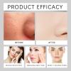 2 Pack Black and White Rice Exfoliant,Which Soothes and Hydrates Skin Gentle Peel Shot Glow Rice Skin Care. view 4