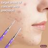 Nobelcrafts - Dual Comodone Extractor - Premium Stainless Steel Blackhead/Acne Remover for Face, Nose, Skin - Professional Dual Sided Skin Tool (Violet) view 4
