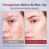 KOEC 2pcs Rice Exfoliating Ampoule Duo,Black & White Rice Peel Shot Glow Rice Ampoule Set,Face Pore Minimizing & Gentle Peel & Deep Hydration view 3