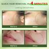 Painless Facial Hair Removal Cream for Women - Sensitive Skin 2-in-1 Kit with Soothing Cream | Upper Lip & Chin Hair Remover | At-Home Depilatory (4 Min, 7 Days Smooth),2.03 Fl Oz view 3