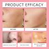 20PCS Facial Wax Strips for Hair Removal, Facial Hair Removal for Women view 2