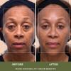 Noor Wonder Lift Cream for Women, Natural Anti-Aging Wrinkle teatment with Syn-Ake natural blend Promotes Anti Aging and Significantly Less Wrinkles In As Little As A Few Days view 3