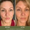 Noor Wonder Lift Cream for Women, Natural Anti-Aging Wrinkle teatment with Syn-Ake natural blend Promotes Anti Aging and Significantly Less Wrinkles In As Little As A Few Days view 4