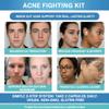 Acne Fighting Kit - Inside-Out Skin Support System with Vitamin B5 Supplement & Probiotic for Skin | Skincare Supplements for Clearer Looking Skin & Oil Balance | Acne Relief Alternative view 4