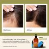 Gya Labs Rosemary & Castor Hair Revival Oil - 4 Fl Oz - Non-Greasy Formula for Thickening & Strengthening - Repairs Damaged Hair, Split Ends & Dry Scalp view 4