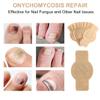 Fungal Nail Patches for Toenails 30 Pcs Toenail Fungus Treatment with Hydrogel Overnight Repair for Damaged Toenails view 4