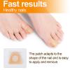 100pcs Nail Repair Patches, Strength Toenail Renewal Fungal Fungus Strips 8-Hour Overnight Ingrown Correction Nursing Plaster for Damaged and Discolored Toe Nails Healthy Appearance view 4