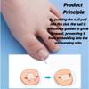 10Pcs Ingrown Toenail Correction Strips Kit, White, Professional Pedicure Straightener Tool view 3