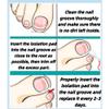 10Pcs Ingrown Toenail Correction Strips Kit, White, Professional Pedicure Straightener Tool view 4