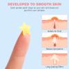HLOES Pimple Patches for Face 360PCS, Hydrocolloid Acne Patches for Covering Zits and Blemishes, Cute Star Pimple Patches, Facial Skin Care Products. view 2