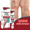 2PCS Varicose Veins treatment for legs,Anti Varicose Vein Soothing Leg Cream,Improves Blood Circulation, Reduces Varicose Veins and Heaviness Lymphatic Massage Cream 20G/0.70OZ view 2
