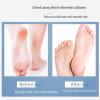 Foldable Double-Sided Foot Scrub Tool - Portable Keratin Remover and Easy Foot Repair Tool view 4