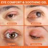 Stye Eye Relief Gel with Tea Tree Oil,Calendula & Vitamin EGentle Soothing Serum for Styes,Chalazion & Blepharitis,Soothing Eyelid & Under Eye Care for Redness,Irritation & Puffiness,1.4oz,2PCS view 2