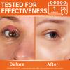 Stye Eye Relief Gel with Tea Tree Oil,Calendula & Vitamin EGentle Soothing Serum for Styes,Chalazion & Blepharitis,Soothing Eyelid & Under Eye Care for Redness,Irritation & Puffiness,1.4oz,2PCS view 3
