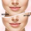 Kradaa Facial Hair Removal for Women: Electric Face Razor with LED Light - Painless & Instant Results Mini Shaver for Travel Use (Rose Gold) view 3