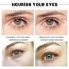 Avocado Eye Mask,Avocado Moisturizing Collagen Eye Mask,Avocados Eyes Patches For Puffy Eyes And Dark Circles,Avocados Essence,Nourishing And Hydrating (2pcs) view 3