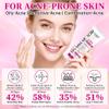 14% Azelaic Acid Acne Cream with Niacinamide & Centella,Azelaic Acid Facial Serum  Smooth & Even Skin Tone,Reduce the Appearance of Blemishes,Dark Spots & Uneven Skin,Gentle Hydrating Formula,1.4oz view 4