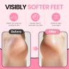 Aluroice Silicone Moisturizing Socks for Women- 2Pairs Foot Moisturizer Socks for Dry Cracked Feet- Pink Aloe Spa Moisture Hydrating Foot Care Socks (S Up to Size 9) view 3