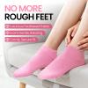 Aluroice Silicone Moisturizing Socks for Women- 2Pairs Foot Moisturizer Socks for Dry Cracked Feet- Pink Aloe Spa Moisture Hydrating Foot Care Socks (S Up to Size 9) view 4