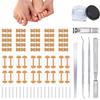 Professional Ingrown Toenail Set with Breathable Ingrown Toenail Strips, Curved Toenails Corrector Patch, Painless File and Lifter Pedicure Tools view 1