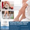 ALFREVER Varicose Veins Treatment for Legs, Varicose Veins Cream, Improves Blood Circulation, Reduces Vein Visibility and Leg Heaviness view 3