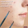 Nobelcrafts - Titanium Comodone Extractor - Premium Titanium Comodone Extractor for Face, Nose, Skin - Professional Double Sided Skin Tool view 3