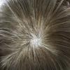 0.06mm Thin Skin Hairpieces for Men Toupee Hair Replacement Systems All V-loop Invisible Hairpiece for Mens Real Human Hair Systems #530#5 Medium Light Brown+30% Grey 8X10-120% Density view 4
