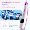 Blackhead Remover Pore Vacuum, Blackhead Vacuum, Facial Pore Cleaner with 5 Adjustable Suction Levels, 5 Probes, USB Rechargeable Pore Cleaner, Electric Comedone Whitehead Extractor Tools Kit view 2