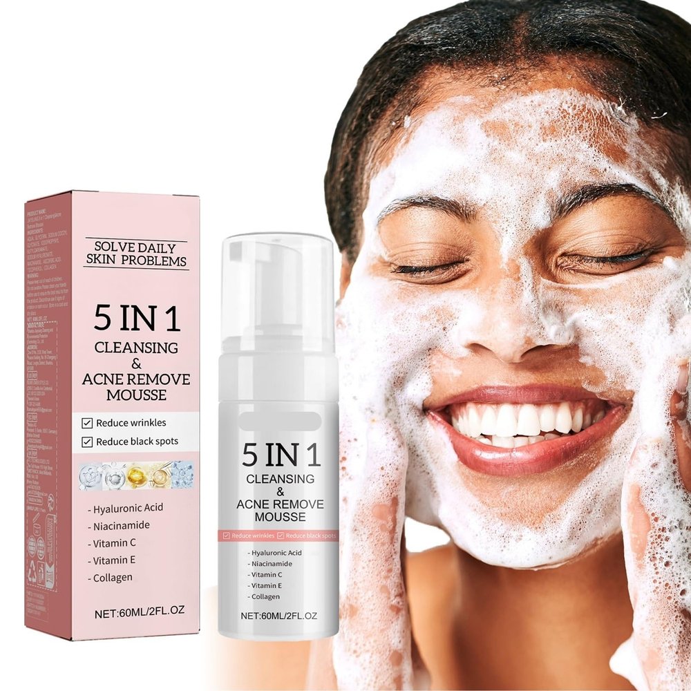 TS TAC-SKY 5-in-1 Facial Cleansing Mousse - Deep Clean Pores, Fade Acne Marks, Remove Blackheads, Oil Control, Brighten Skin(2PCS)