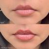 Revive7 Plump + Protect Lip Serum view 2