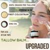 100% Grass Fed Tallow Balm with First Colostrum & Emu Oil - Handmade in USA Whipped Beef Tallow for Face and Body, Sensitive Skin Tallow Moisturizer made with True First Colostrum, (Lavender Mist) view 2