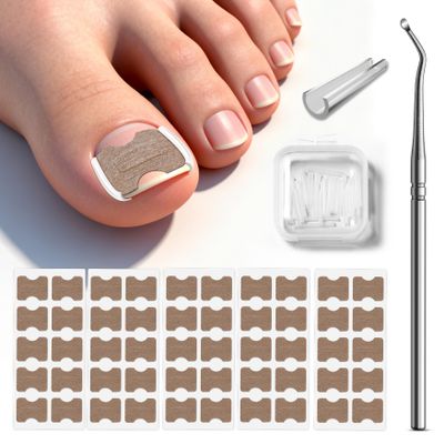 BALUCA 2025 Upgraded Ingrown Toenail Corrector Kit | Professional Ingrown Toenail Treatment & Pain Relief | Home Pedicure Tool Set with Breathable Corrector Strips & Toenail Tools