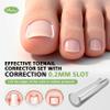 BALUCA 2025 Upgraded Ingrown Toenail Corrector Kit | Professional Ingrown Toenail Treatment & Pain Relief | Home Pedicure Tool Set with Breathable Corrector Strips & Toenail Tools view 3