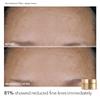 Dr Dennis Gross Plump & Smooth Limited Edition Kit  DermInfusions Blur + Repair Cream (0.67 oz) + 5 Alpha Beta Universal Daily Peels | $50 Value view 3