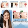 EFAH Care 2Pcs Stainless Steel Pimple Extractor Acne Treatment Tool Surgical Blemish Grade Blackhead Remover Perfect for face and Nose Easy to Clean (Black) view 4