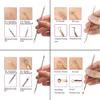 Blackhead Remover Pimple Comedone Extractor Tool Best Acne Removal Kit - Treatment for Blemish, Whitehead Popping, Zit Removing for Risk Free Nose Face Skin with Case (Pack of 1) view 3