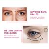 Awjsde Calcium Multi Balm, Calcium Volume Multi Balm, Wrinkle Core Stick, Korean Collagen Moisturing Stick, Anti-aging, Hydrating, Reduce fine lines, Suitable for Eyes, Neck, Face view 4