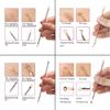 Blackhead Remover Pimple Comedone Extractor Tool Best Acne Removal Kit - Treatment for Blemish, Whitehead Popping, Zit Removing for Risk Free Nose Face Skin with Case (Pack of 1) view 3