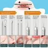 8-Piece Blackhead Remover Tool Kit - Professional Pimple Popper Extractor Set for Acne, Comedones, Whiteheads & Blemishes - Stainless Steel with Metal Case view 3