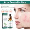 Acne Scar Fading Serum, Pore Minimizing Hydrating Essence - Brightens & Repairs Skin, Makes Skin Smooth, Easy To Use(2PCS) view 4