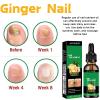 2Pcs Ginger Nail, Ginger Cuticle Care Oil For Nails, Ginger Serum Solution, Cuticle Serum For Nails view 2